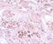 Secernin 1 antibody, A10002, Boster Biological Technology, Immunohistochemistry paraffin image 