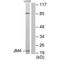 PRA1 Domain Family Member 2 antibody, A11750, Boster Biological Technology, Western Blot image 