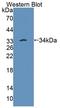 Protein Tyrosine Phosphatase Non-Receptor Type 22 antibody, LS-C663343, Lifespan Biosciences, Western Blot image 