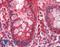Galectin 3 antibody, LS-B9424, Lifespan Biosciences, Immunohistochemistry frozen image 