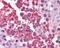 RuvB Like AAA ATPase 2 antibody, GTX102037, GeneTex, Immunohistochemistry paraffin image 