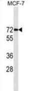 Estrogen Receptor 1 antibody, abx025379, Abbexa, Western Blot image 