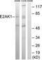 Eukaryotic Translation Initiation Factor 2 Alpha Kinase 1 antibody, TA315366, Origene, Western Blot image 