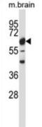 Calcium/Calmodulin Dependent Protein Kinase II Beta antibody, abx027860, Abbexa, Western Blot image 