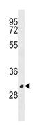 CD20 antibody, abx029190, Abbexa, Western Blot image 