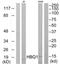 Hemoglobin Subunit Theta 1 antibody, TA313997, Origene, Western Blot image 