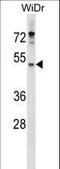 Ectonucleotide Pyrophosphatase/Phosphodiesterase 4 antibody, LS-C159532, Lifespan Biosciences, Western Blot image 