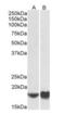 ADP Ribosylation Factor 4 antibody, orb12320, Biorbyt, Western Blot image 