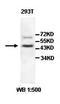 3-Oxoacyl-ACP Synthase, Mitochondrial antibody, orb77772, Biorbyt, Western Blot image 