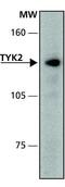 Tyrosine Kinase 2 antibody, GTX30812, GeneTex, Western Blot image 
