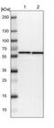 Chaperonin Containing TCP1 Subunit 7 antibody, NBP1-88144, Novus Biologicals, Western Blot image 