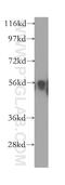 Inositol Hexakisphosphate Kinase 1 antibody, 12057-2-AP, Proteintech Group, Western Blot image 