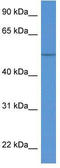 Keratin 36 antibody, TA343128, Origene, Western Blot image 