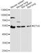 ETS Variant 6 antibody, LS-C331603, Lifespan Biosciences, Western Blot image 