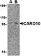 Caspase Recruitment Domain Family Member 10 antibody, orb74470, Biorbyt, Western Blot image 