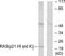 HRas Proto-Oncogene, GTPase antibody, TA326254, Origene, Western Blot image 