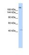 RNA Polymerase III Subunit A antibody, orb330565, Biorbyt, Western Blot image 