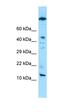 Variable Charge Y-Linked 1B antibody, orb326563, Biorbyt, Western Blot image 