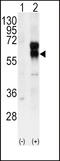 Activin A Receptor Like Type 1 antibody, 63-213, ProSci, Western Blot image 