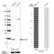 Solute Carrier Family 51 Beta Subunit antibody, NBP1-91108, Novus Biologicals, Western Blot image 