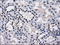 Tubulin Tyrosine Ligase Like 12 antibody, LS-C114874, Lifespan Biosciences, Immunohistochemistry paraffin image 