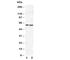 Solute Carrier Family 22 Member 6 antibody, R30768, NSJ Bioreagents, Western Blot image 