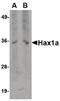 HCLS1 Associated Protein X-1 antibody, MA5-15770, Invitrogen Antibodies, Western Blot image 