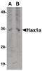 HCLS1 Associated Protein X-1 antibody, MA5-15770, Invitrogen Antibodies, Western Blot image 