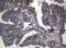 Cathepsin L antibody, LS-C794875, Lifespan Biosciences, Immunohistochemistry paraffin image 