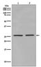 Eukaryotic Translation Initiation Factor 4E antibody, P00135, Boster Biological Technology, Western Blot image 