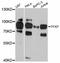 Phosphofructokinase, Platelet antibody, A12160, ABclonal Technology, Western Blot image 