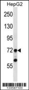 TATA-Box Binding Protein Associated Factor 6 antibody, 57-846, ProSci, Western Blot image 