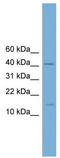 PBX Homeobox 4 antibody, TA329957, Origene, Western Blot image 