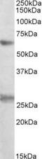 Eukaryotic Translation Initiation Factor 2B Subunit Delta antibody, TA311589, Origene, Western Blot image 