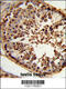 Centrosome And Spindle Pole Associated Protein 1 antibody, 63-921, ProSci, Immunohistochemistry paraffin image 
