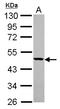 Tyrosyl-tRNA synthetase, mitochondrial antibody, LS-C155589, Lifespan Biosciences, Western Blot image 