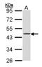 Ribonucleotide Reductase Regulatory Subunit M2 antibody, NBP1-31661, Novus Biologicals, Western Blot image 