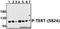 Telomerase Reverse Transcriptase antibody, A00012S824, Boster Biological Technology, Western Blot image 