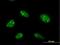 Zinc Finger Protein 593 antibody, H00051042-B02P, Novus Biologicals, Immunofluorescence image 
