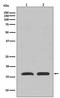 Translocator protein antibody, M01153, Boster Biological Technology, Western Blot image 