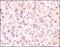 Solute Carrier Family 2 Member 2 antibody, NBP2-22218, Novus Biologicals, Immunohistochemistry frozen image 