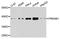 Protein Kinase AMP-Activated Non-Catalytic Subunit Beta 1 antibody, A12491, ABclonal Technology, Western Blot image 