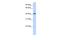 Leucine Rich Repeat Containing 2 antibody, A16692, Boster Biological Technology, Western Blot image 
