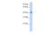 Leucine Rich Repeat Containing 2 antibody, A16692, Boster Biological Technology, Western Blot image 