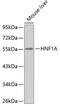 HNF1 Homeobox A antibody, 18-937, ProSci, Western Blot image 