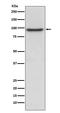 Prospero Homeobox 1 antibody, M01985, Boster Biological Technology, Western Blot image 