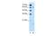 Cytochrome P450 Family 4 Subfamily A Member 22 antibody, PA5-42071, Invitrogen Antibodies, Western Blot image 