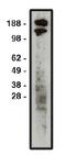 Roundabout Guidance Receptor 1 antibody, orb109381, Biorbyt, Western Blot image 
