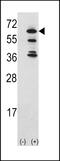 ACK1 antibody, 63-156, ProSci, Western Blot image 