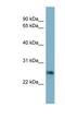 Neurotrophin 4 antibody, NBP1-59313, Novus Biologicals, Western Blot image 